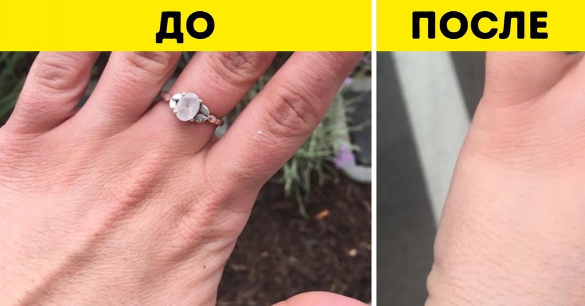 12 человек рассказали, как они добились идеальной кожи. Из их историй есть что почерпнуть