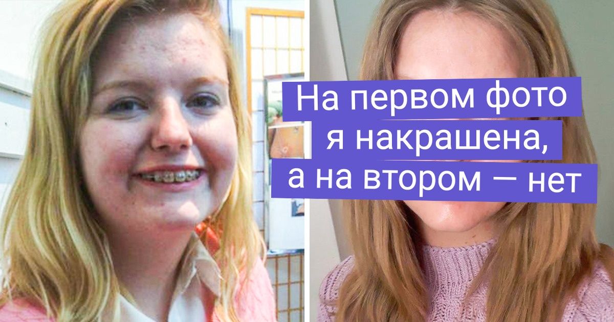 20+ неказистых подростков, которые выросли в красавиц и красавцев и теперь могут утереть нос любой голливудской звезде 20+ неказистых подростков, которые выросли в красавиц и красавцев и теперь могут утереть нос любой голливудской звезде