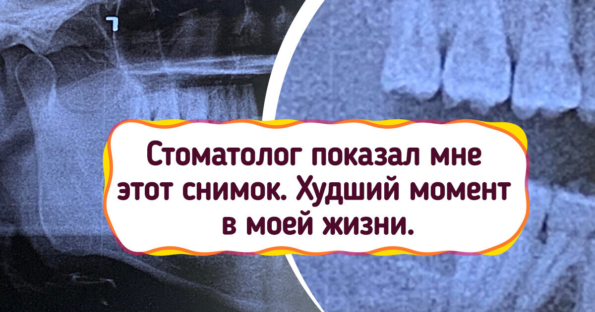 17 человек поделились случаями, когда что-то в их жизни пошло не по плану 17 человек поделились случаями, когда что-то в их жизни пошло не по плану