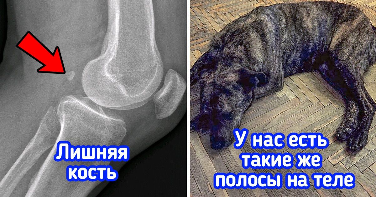 15 фактов о человеческом теле, которые докажут, что природа создала воистину уникальное существо 15 фактов о человеческом теле, которые докажут, что природа создала воистину уникальное существо
