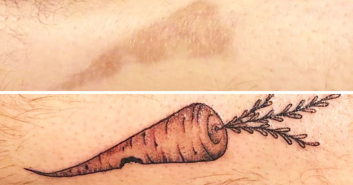 25 татуировок, которые превратили изъяны кожи в произведения искусства 25 татуировок, которые превратили изъяны кожи в произведения искусства