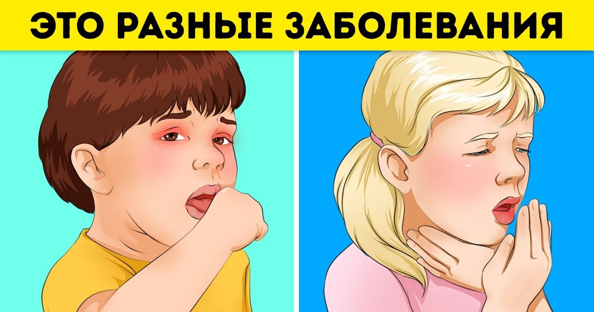 У ребёнка болит горло: как отличить ангину