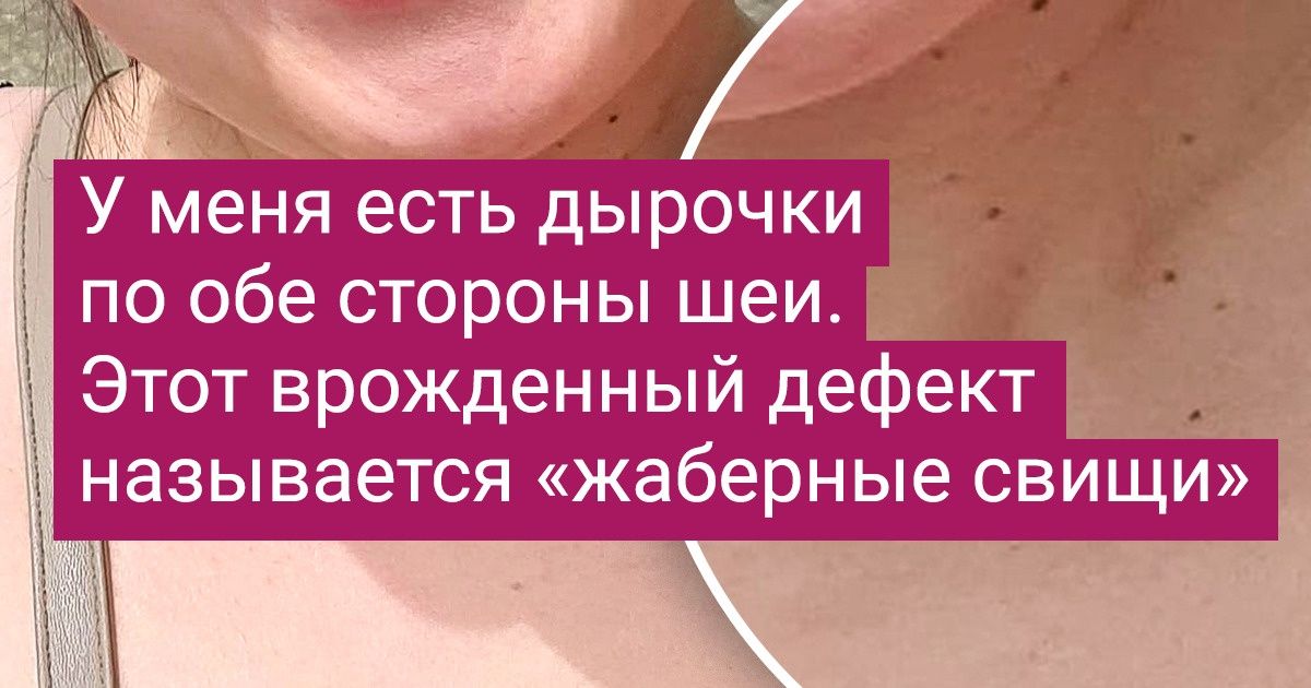 19 человек, которых природа наградила такими эксклюзивными особенностями, что у нас челюсть отваливается 19 человек, которых природа наградила такими эксклюзивными особенностями, что у нас челюсть отваливается