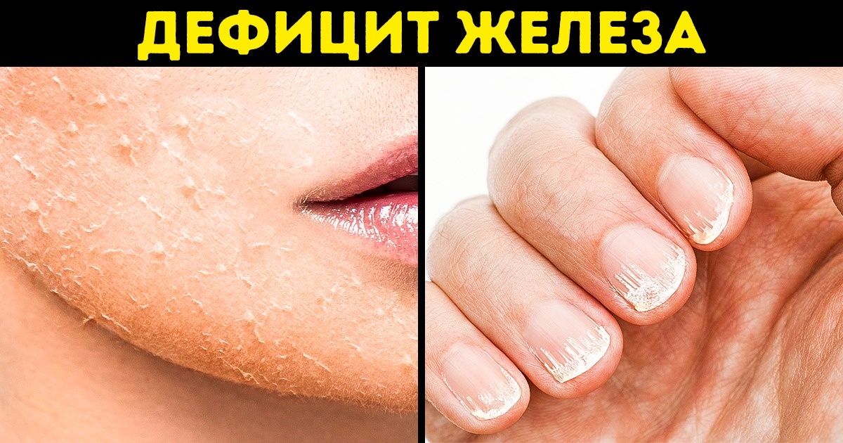 5 полезных веществ, которых чаще всего не хватает нашему организму, и откуда их получить 5 полезных веществ, которых чаще всего не хватает нашему организму, и откуда их получить