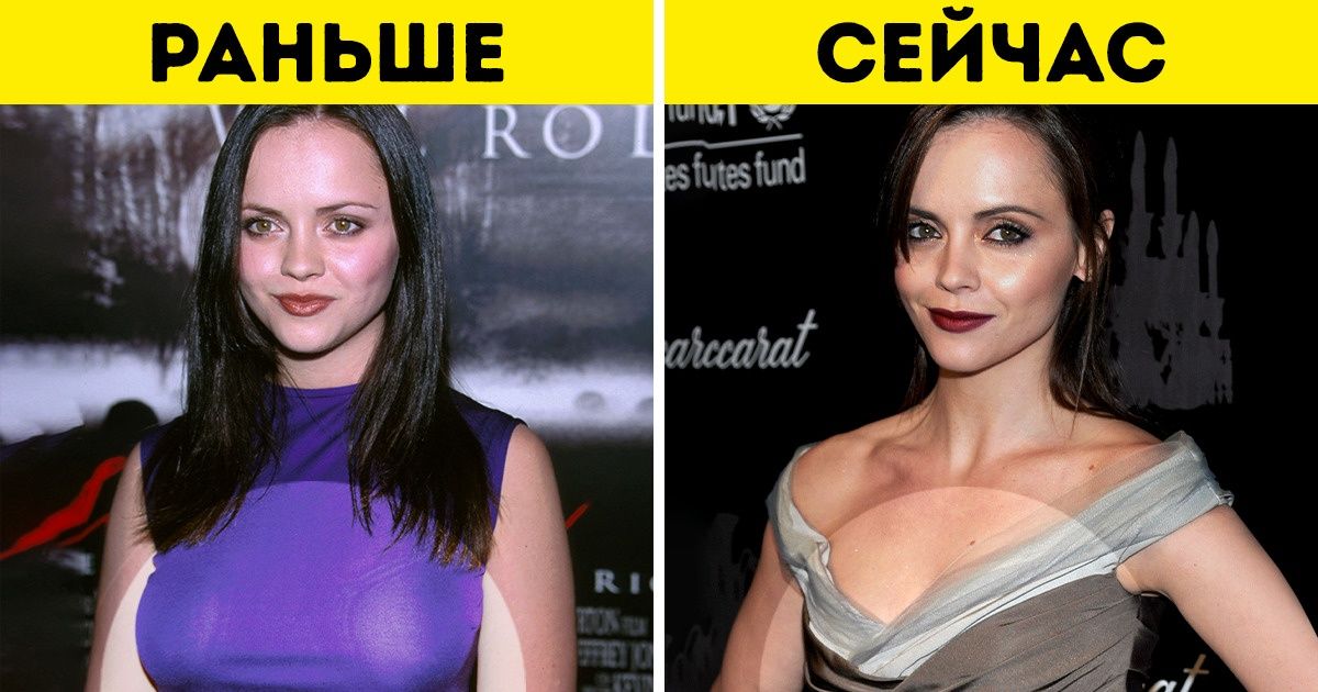 11 звезд, которые пустились во все тяжкие и с размахом поколдовали над внешностью 11 звезд, которые пустились во все тяжкие и с размахом поколдовали над внешностью