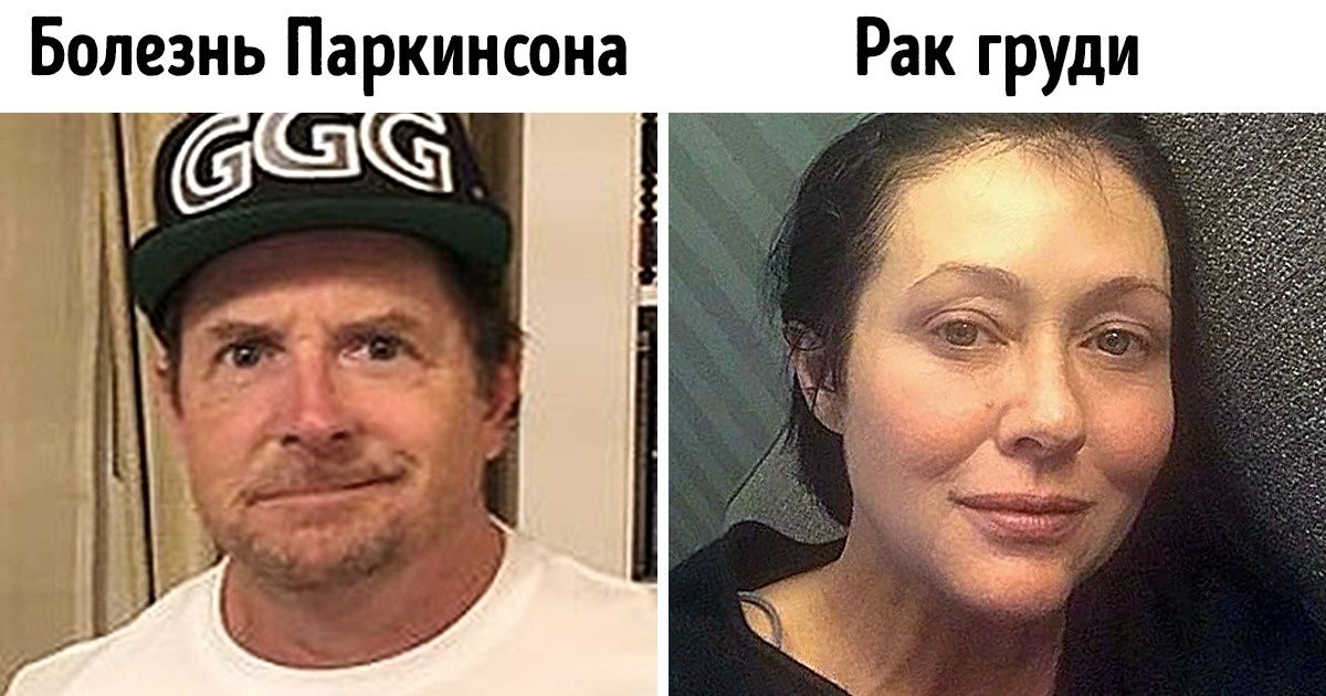15 знаменитостей, которых не сломили даже серьезные проблемы со здоровьем 15 знаменитостей, которых не сломили даже серьезные проблемы со здоровьем