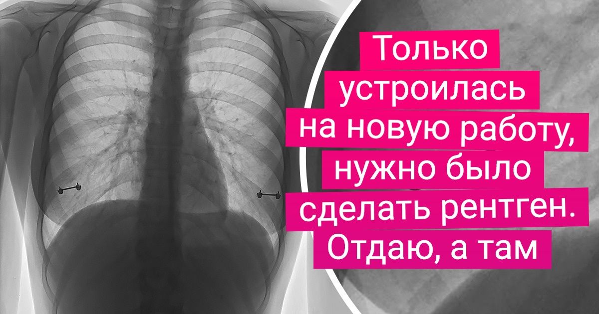 Рентген по фото онлайн бесплатно без регистрации и скачивания