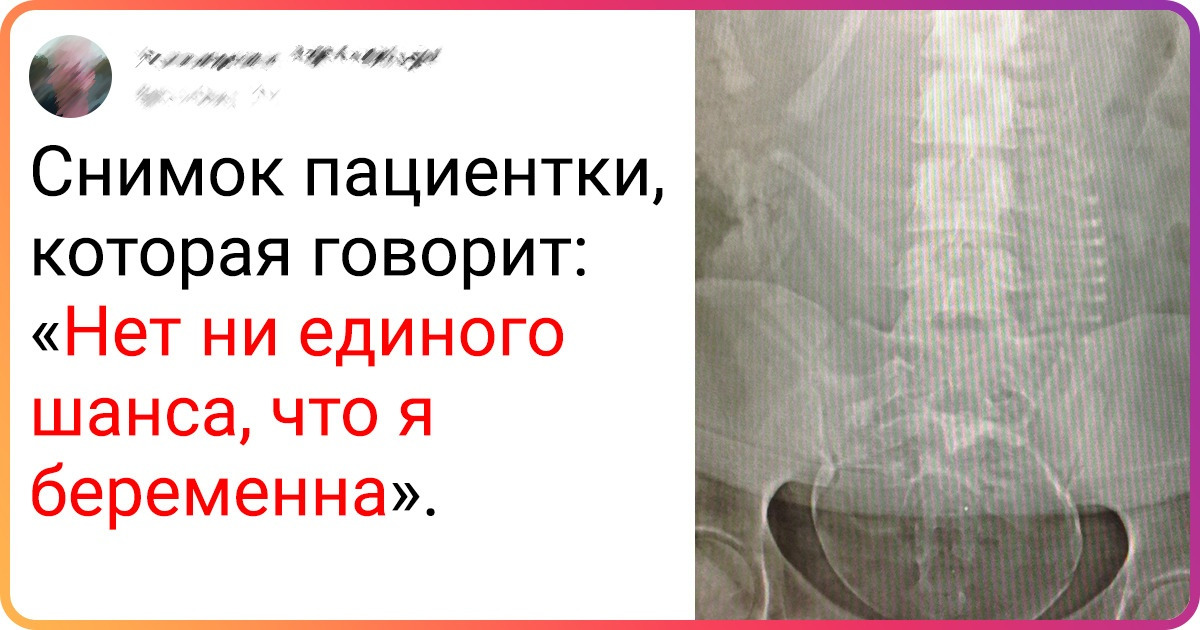 16 доказательств того, что рентгеновское изображение может поведать кучу секретов 16 доказательств того, что рентгеновское изображение может поведать кучу секретов