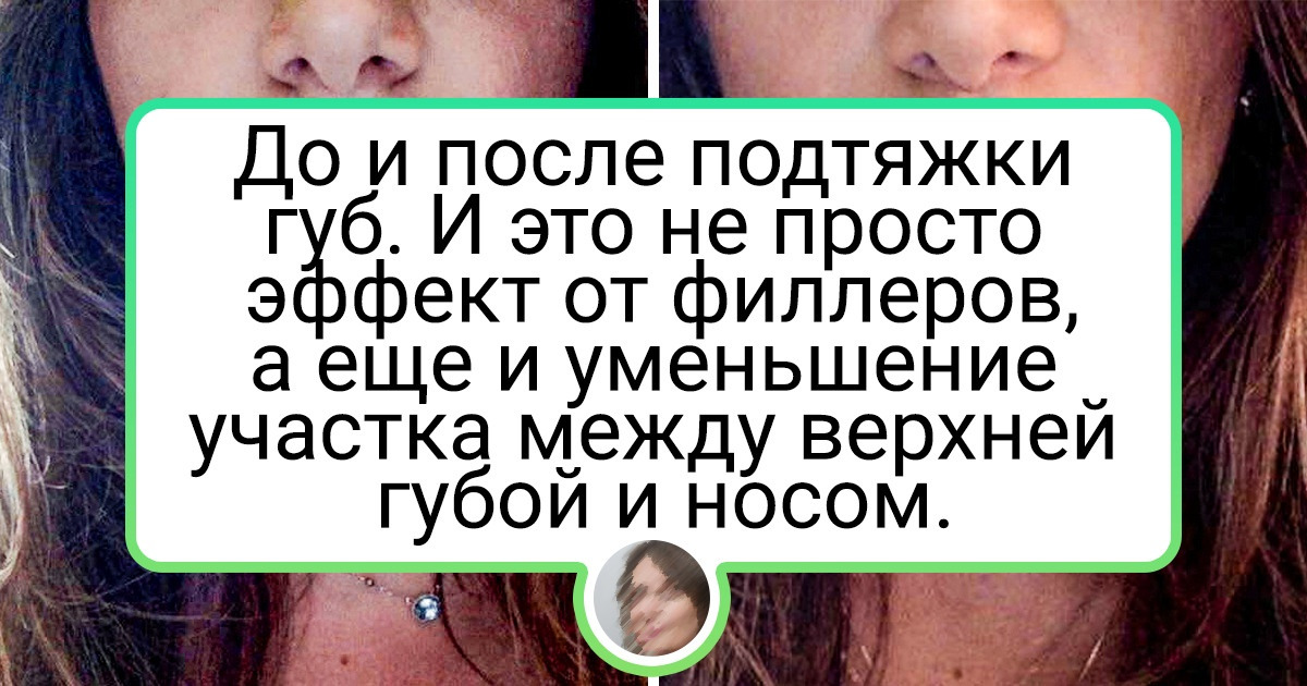 17 человек, которые решились на изменение внешности и теперь не могут налюбоваться на себя 17 человек, которые решились на изменение внешности и теперь не могут налюбоваться на себя