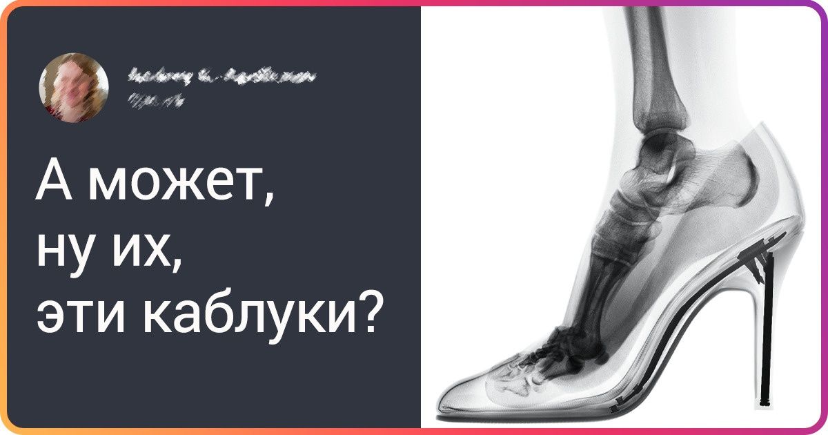 14 рентгеновских снимков, которые на раз-два раскроют секреты буквально всего на свете
