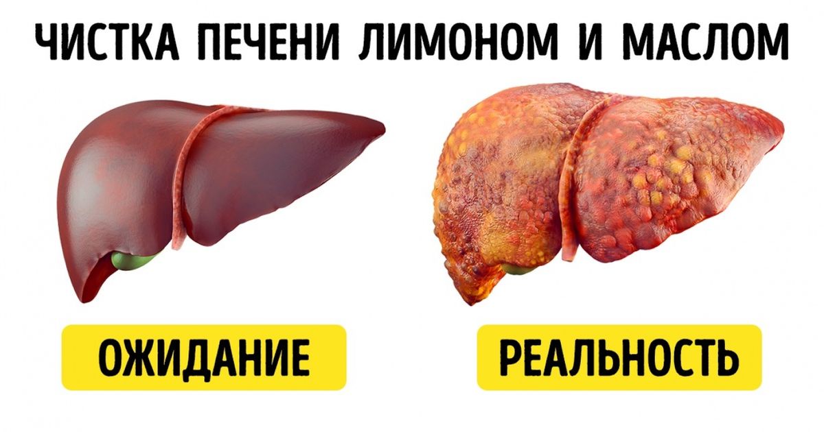 Различные заболевания и лечение средствами народной медицины thumbnail