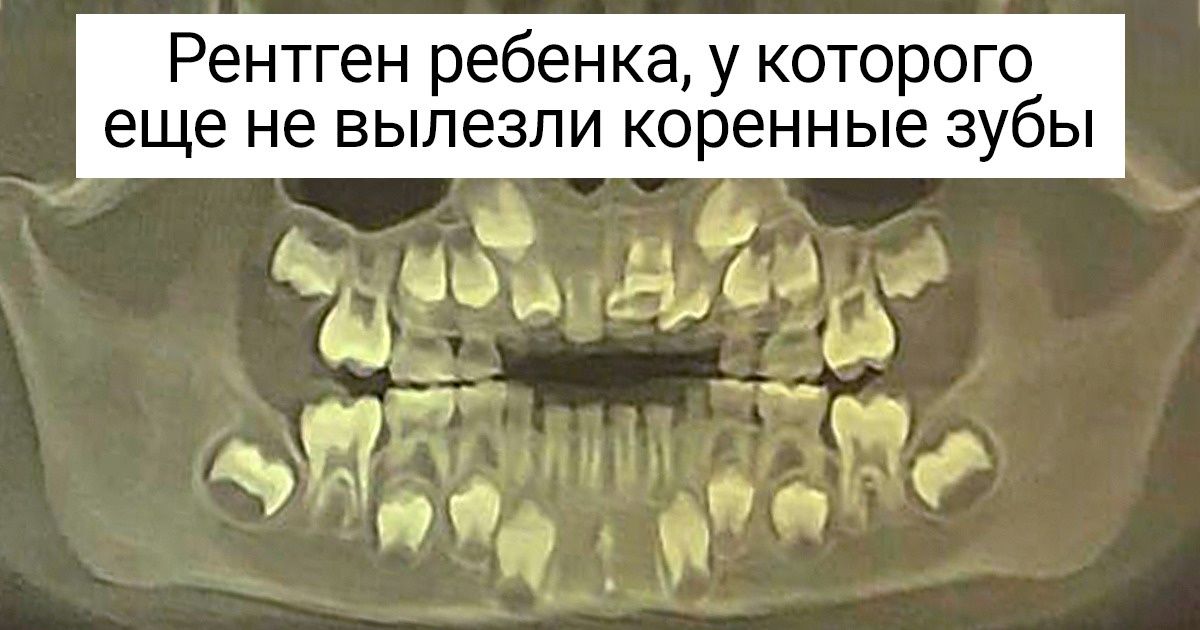 15 рентгеновских снимков, которые показывают скрытые стороны нашей жизни 15 рентгеновских снимков, которые показывают скрытые стороны нашей жизни
