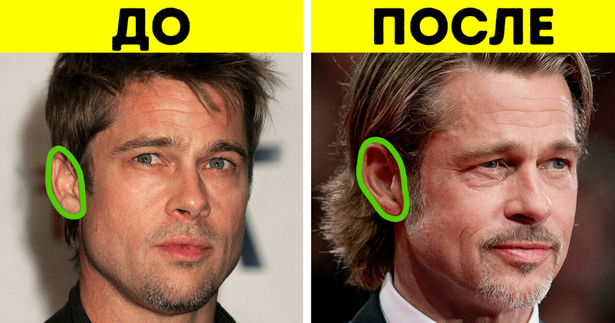 Действительно ли уши никогда не перестают расти? Действительно ли уши никогда не перестают расти?