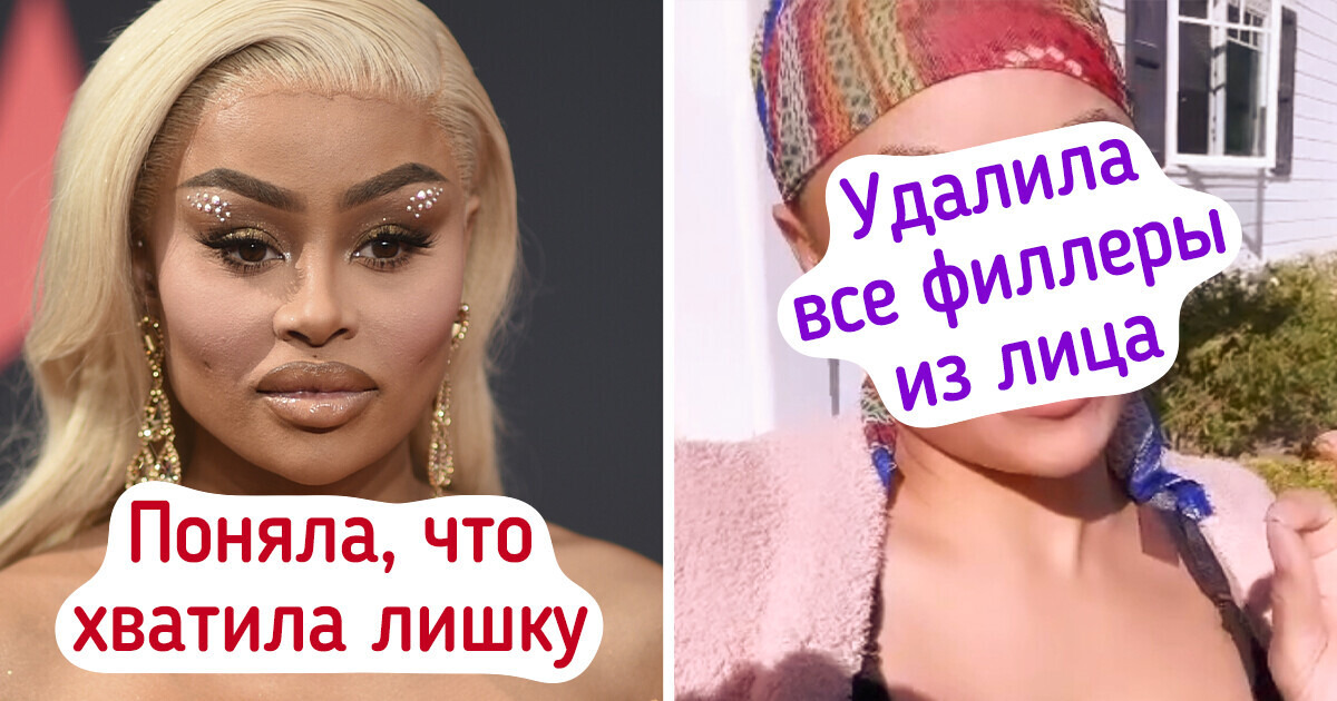 9 звезд, которые сделали модные бьюти-процедуры и горько пожалели об этом 9 звезд, которые сделали модные бьюти-процедуры и горько пожалели об этом