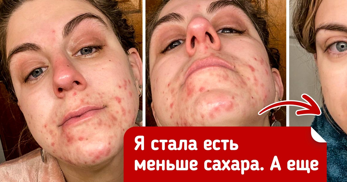20+ человек, которые сделали снимки «до» и «после» и сами ахнули от прогресса 20+ человек, которые сделали снимки «до» и «после» и сами ахнули от прогресса