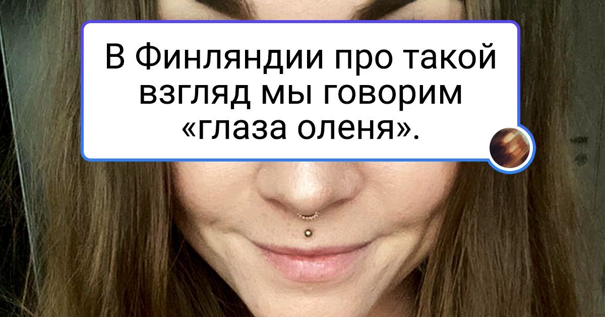 20+ везунчиков, которых природа одарила яркой особенностью и дала почувствовать себя уникальным 20+ везунчиков, которых природа одарила яркой особенностью и дала почувствовать себя уникальным
