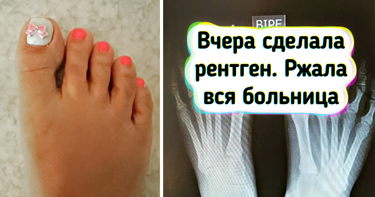 14 рентгеновских снимков, которые ясно покажут, как устроен наш мир 14 рентгеновских снимков, которые ясно покажут, как устроен наш мир