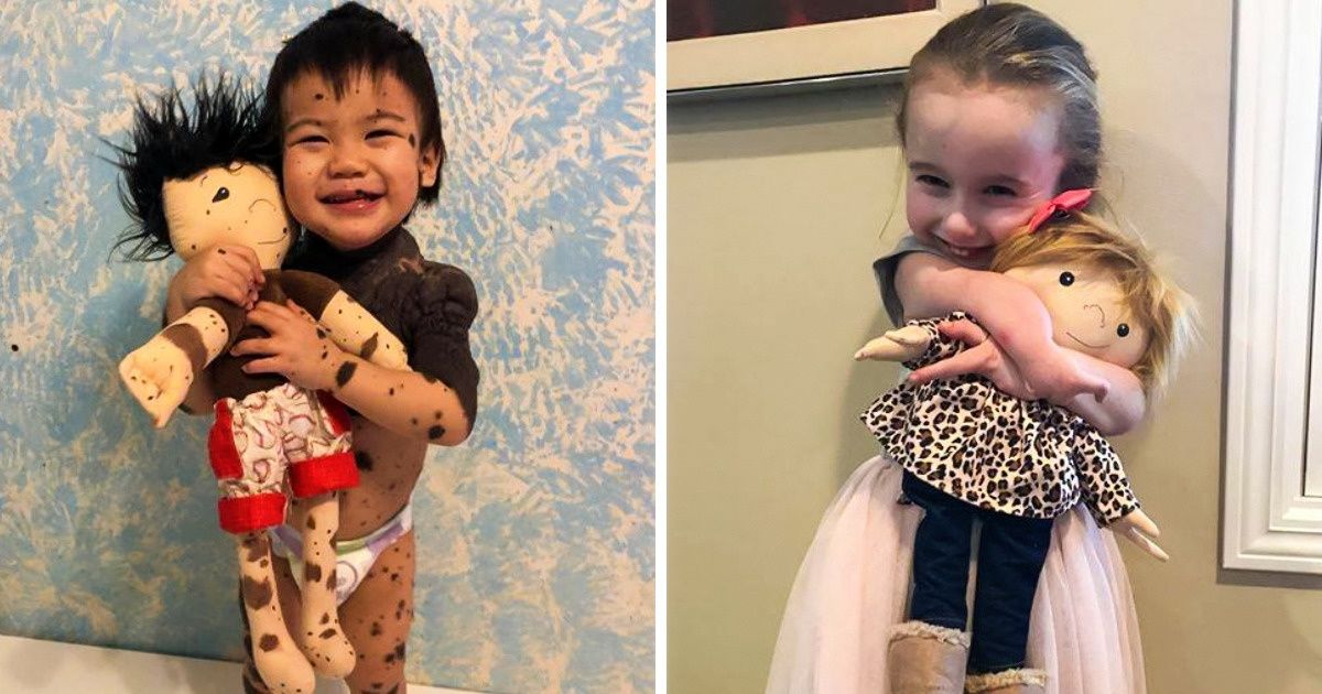 Женщина делает кукол, которые помогают детям гордиться своей необычной внешностью Женщина делает кукол, которые помогают детям гордиться своей необычной внешностью