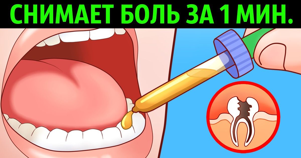 Снять зубную боль | Zub64
