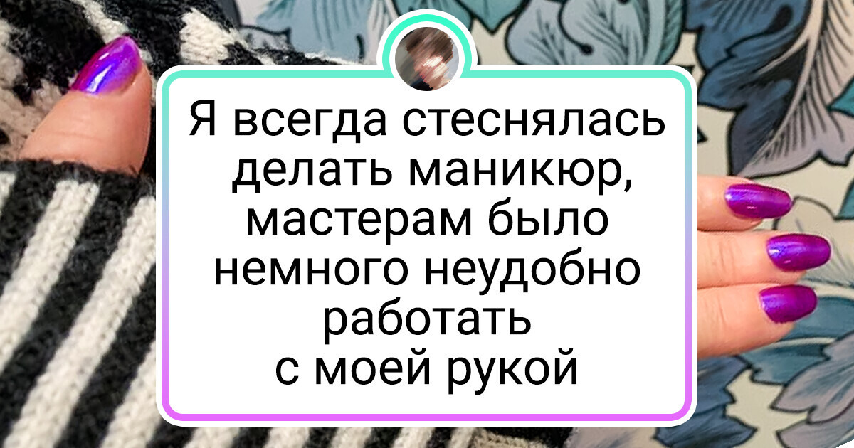15+ человек человек, чья визитная карточка — изюминка во внешности 15+ человек человек, чья визитная карточка — изюминка во внешности