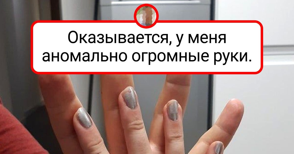 16 человек, чей организм сумел удивить не только их самих, но и окружающих 16 человек, чей организм сумел удивить не только их самих, но и окружающих
