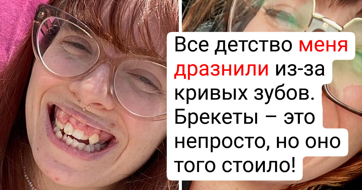 20 фото, которые показывают, насколько огромной бывает разница 20 фото, которые показывают, насколько огромной бывает разница