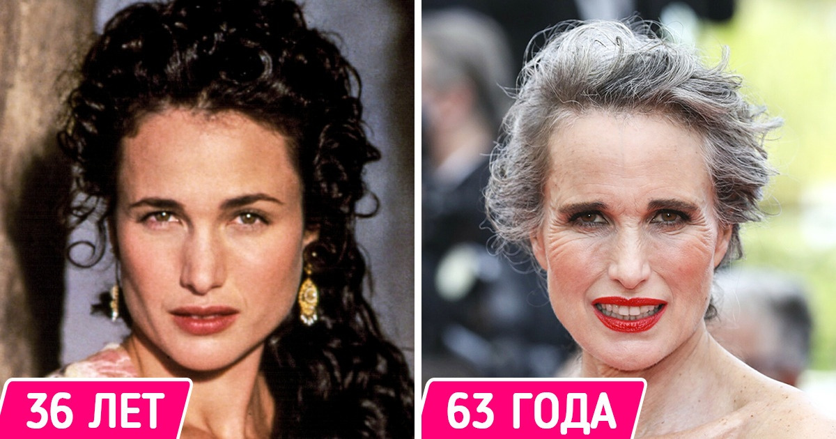 10+ знаменитостей, которые выглядят уже совсем не так, как мы помним 10+ знаменитостей, которые выглядят уже совсем не так, как мы помним