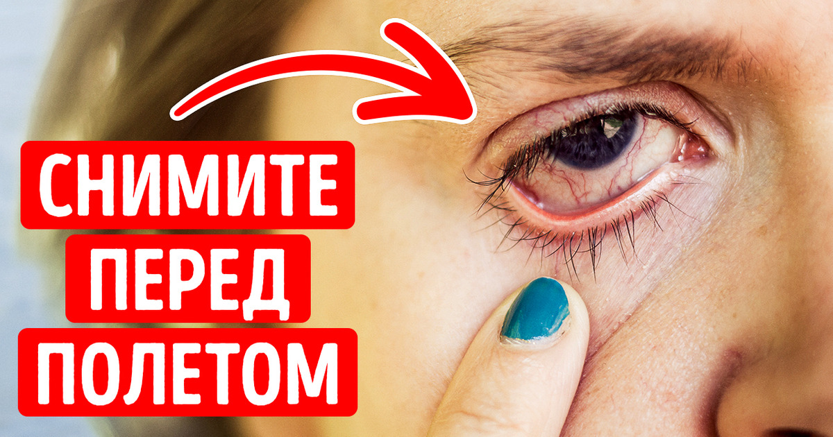 Почему нужно снимать линзы перед посадкой в самолет Почему нужно снимать линзы перед посадкой в самолет