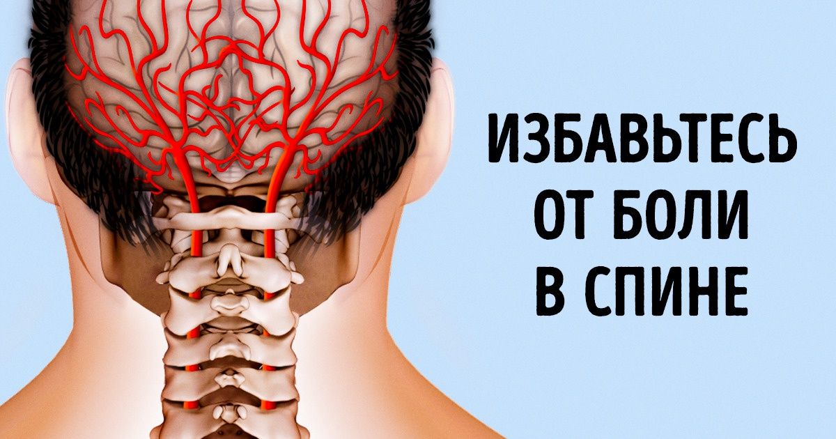 Как лечить растяжение мышц шеи, причины, симптомы в Москве