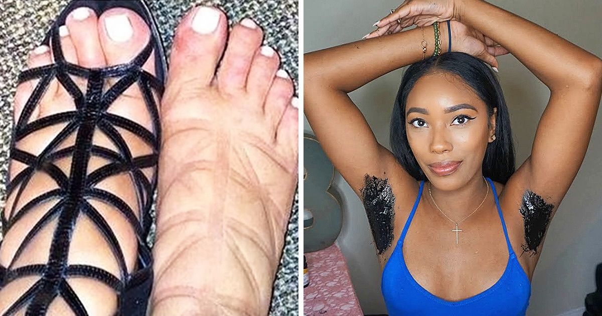 Трюки по уходу за кожей Трюки по уходу за кожей thumbnail