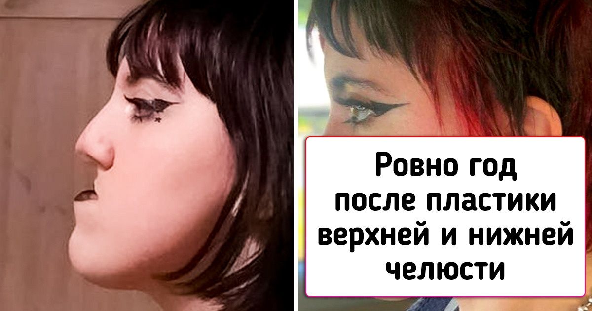 19 человек, которые однажды решились на пластическую операцию и в результате сорвали настоящий джекпот 19 человек, которые однажды решились на пластическую операцию и в результате сорвали настоящий джекпот