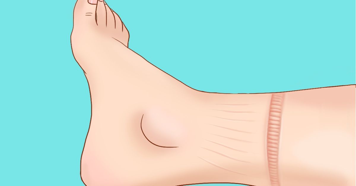 8 опасных признаков проблем с сердцем 8 опасных признаков проблем с сердцем