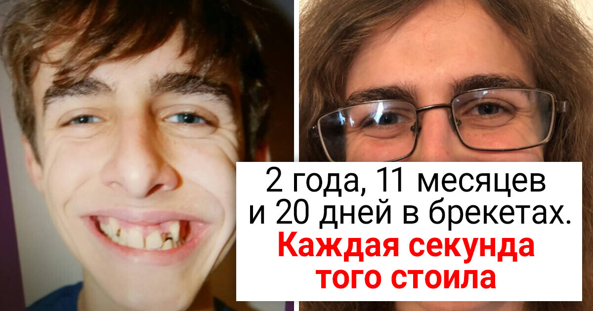 15+ фото до и после, которые показывают, на какие выкрутасы способно время 15+ фото до и после, которые показывают, на какие выкрутасы способно время