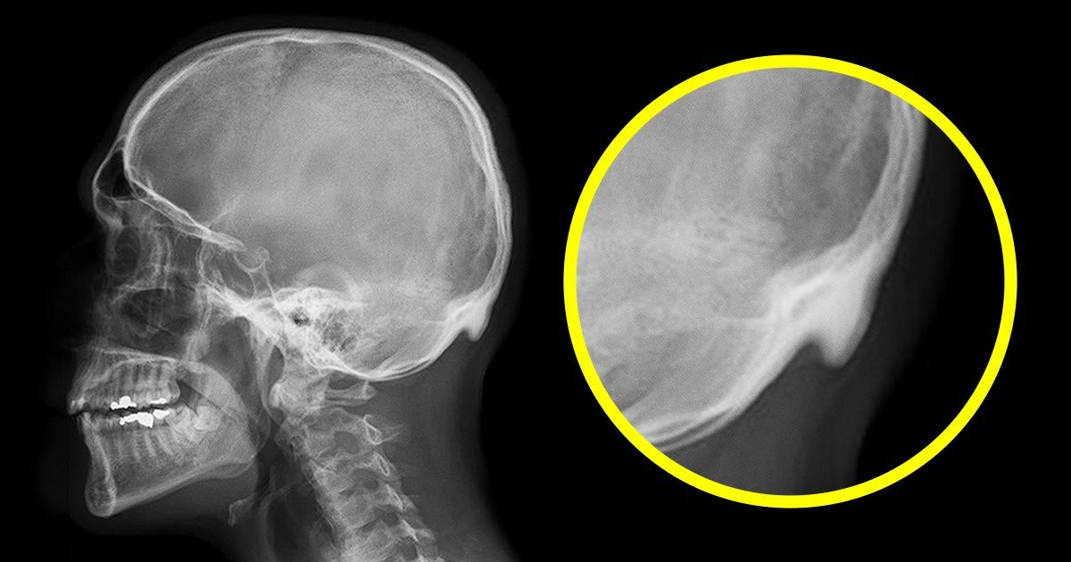 Ученые выяснили, что гаджеты уже успели повлиять на строение нашего скелета