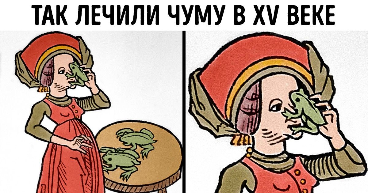 7 достижений медицины прошлого, от которых бросает в дрожь 7 достижений медицины прошлого, от которых бросает в дрожь
