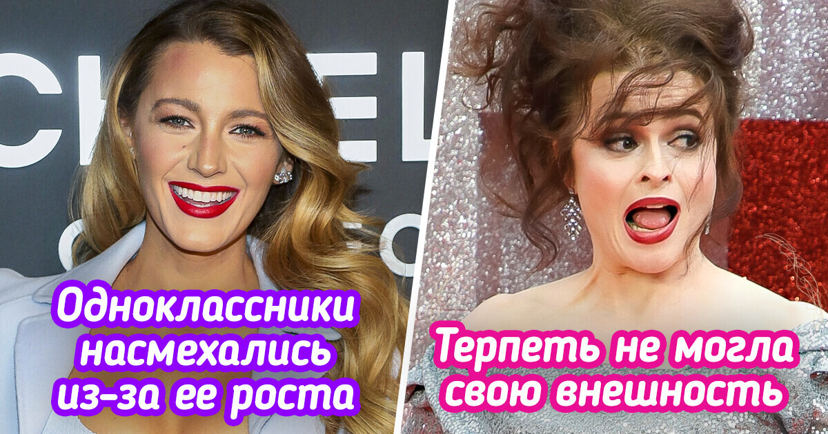 13 знаменитых красоток, которые когда-то жутко комплексовали, а теперь сияют на звездном Олимпе 13 знаменитых красоток, которые когда-то жутко комплексовали, а теперь сияют на звездном Олимпе