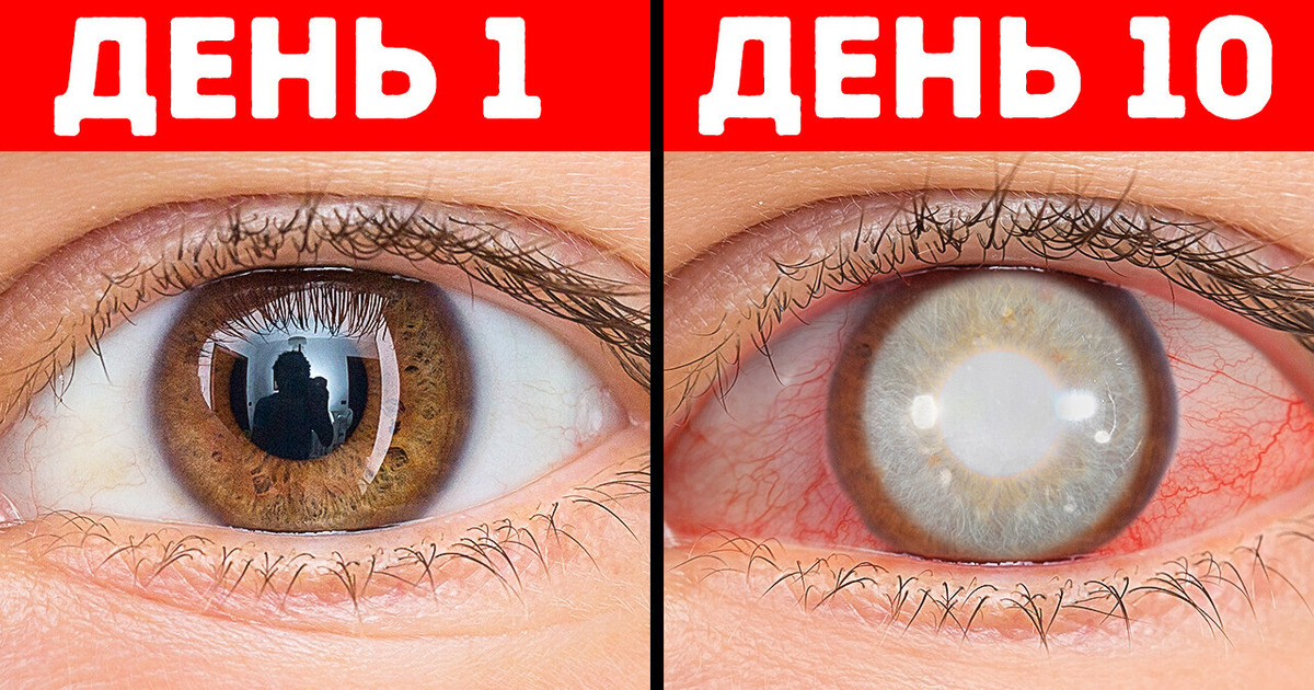 Что произойдет, если вы перестанете моргать Что произойдет, если вы перестанете моргать