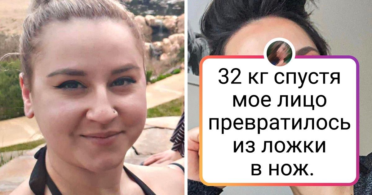 20+ человек, которые хотели стать чуть красивее и остались довольны результатом 20+ человек, которые хотели стать чуть красивее и остались довольны результатом