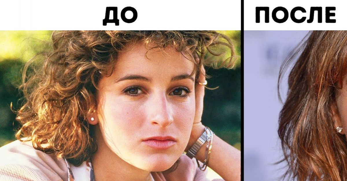 Как выглядели 10 звезд до того, как обратились к пластическим хирургам Как выглядели 10 звезд до того, как обратились к пластическим хирургам