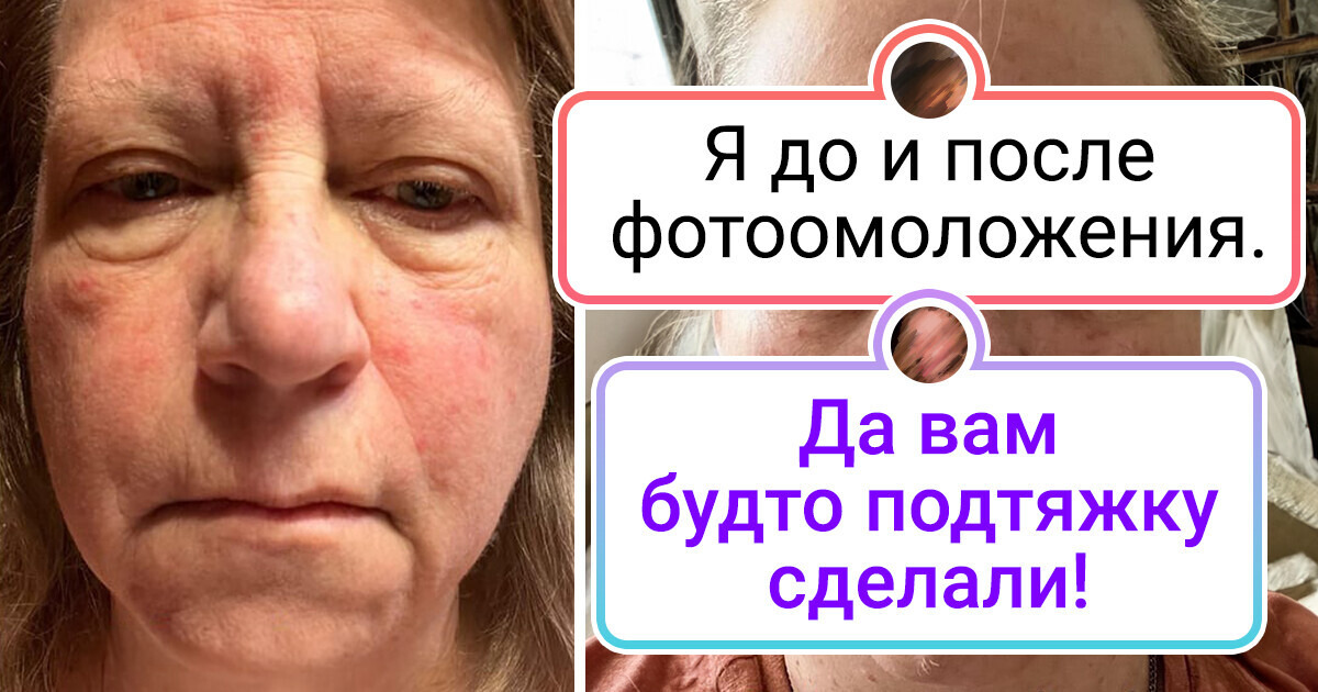 19 женщин показали, как преображается кожа лица, когда начинаешь за ней ухаживать 19 женщин показали, как преображается кожа лица, когда начинаешь за ней ухаживать