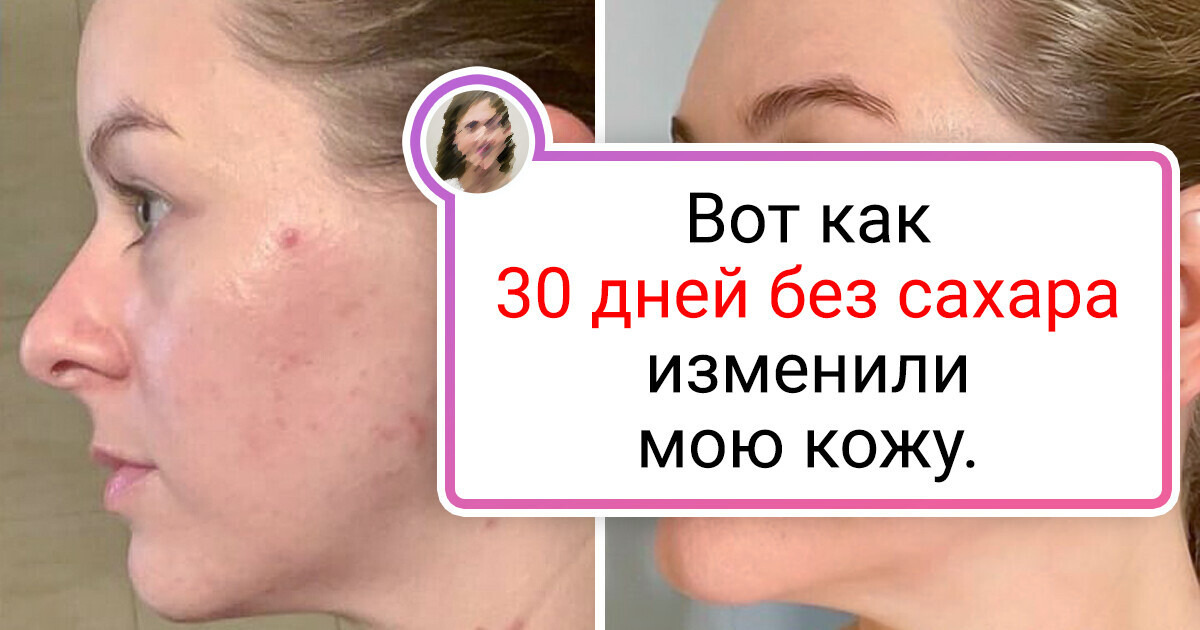 20+ фото, наглядно показывающих, что такое «заметная разница» 20+ фото, наглядно показывающих, что такое «заметная разница»