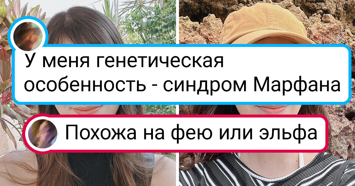 16 человек, чья особенная внешность магнитом притягивает взгляды окружающих 16 человек, чья особенная внешность магнитом притягивает взгляды окружающих