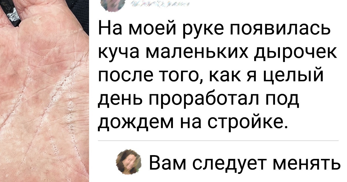 18 случаев, когда человеческое тело задало своим владельцам немало вопросов. И нам тоже 18 случаев, когда человеческое тело задало своим владельцам немало вопросов. И нам тоже