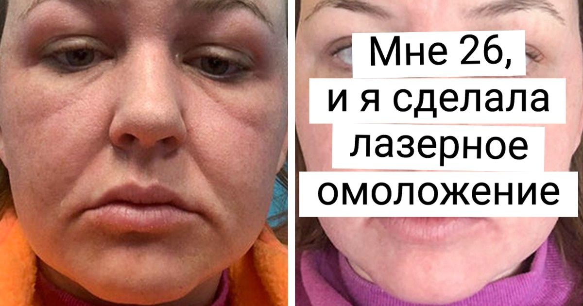 18 девушек и парней, которые решились на перемены и теперь не могут наглядеться в зеркало 18 девушек и парней, которые решились на перемены и теперь не могут наглядеться в зеркало