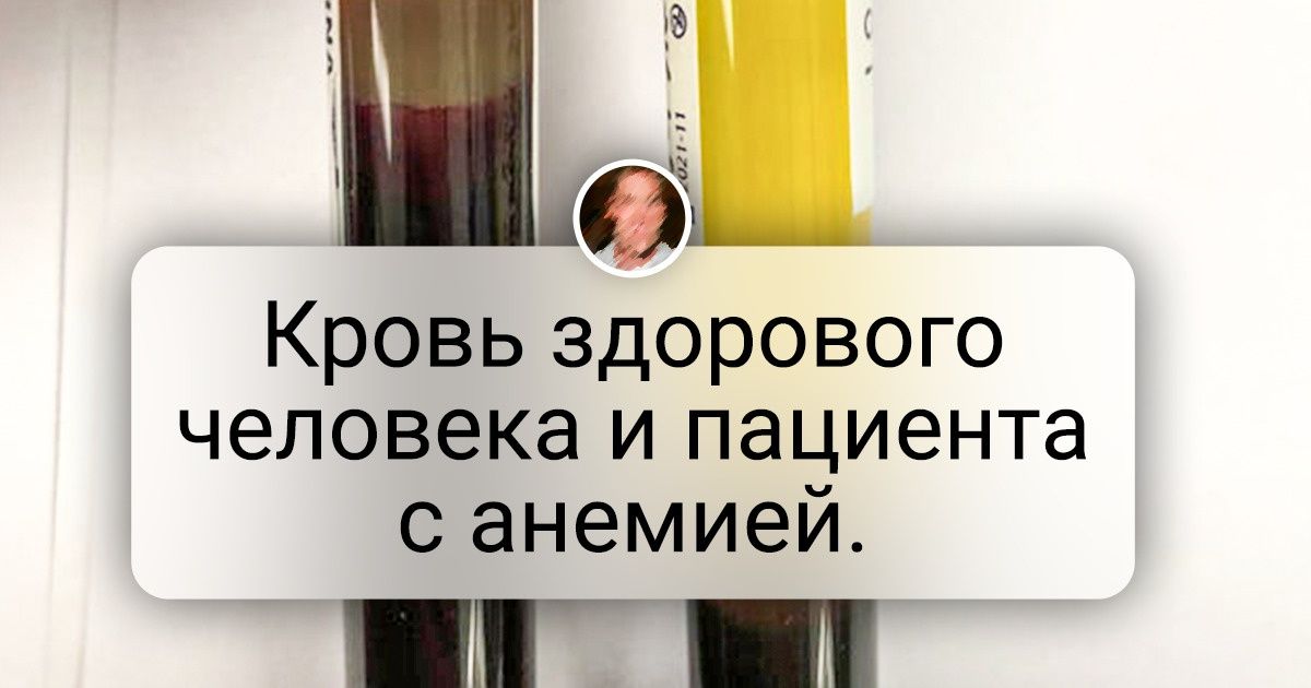 18 контрастных фото, которые в два счета объяснят то, что обычно приходится долго гуглить 18 контрастных фото, которые в два счета объяснят то, что обычно приходится долго гуглить