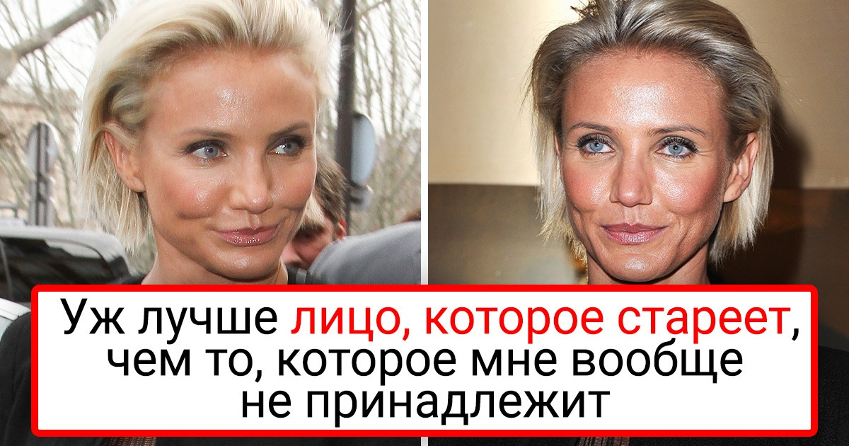 8 знаменитостей, которые однажды решились на пластическую операцию и сказали: «Больше ни за какие коврижки» 8 знаменитостей, которые однажды решились на пластическую операцию и сказали: «Больше ни за какие коврижки»