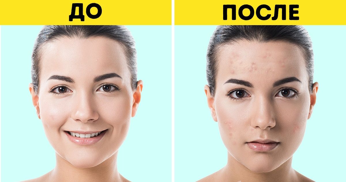 7 косметических продуктов, которые попали в черный список дерматологов 7 косметических продуктов, которые попали в черный список дерматологов