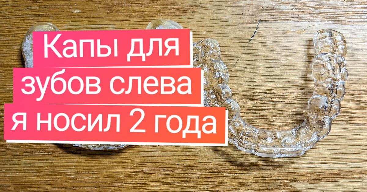 19 человек, которые наглядно показали, как отражается время на обыденных вещах