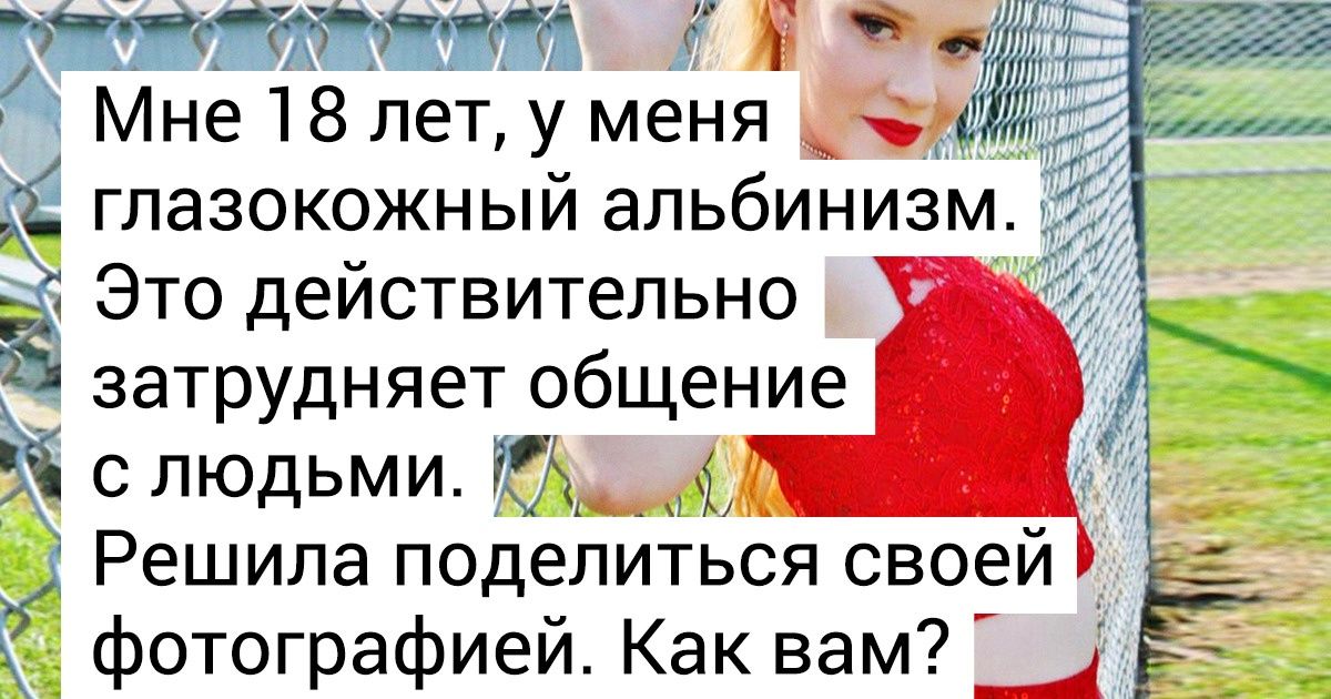 20+ человек, которым нет необходимости выделяться из толпы, за них это сделала природа 20+ человек, которым нет необходимости выделяться из толпы, за них это сделала природа