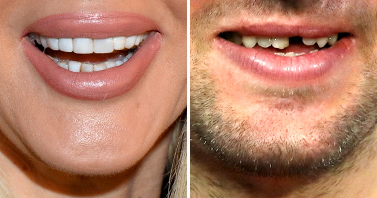 20+ наших знаменитостей, которых непросто угадать лишь по одной части их тела 20+ наших знаменитостей, которых непросто угадать лишь по одной части их тела